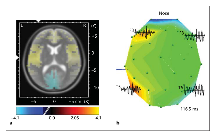 Paper 158 · fig-3
